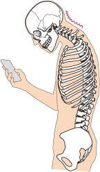 ストレートネック