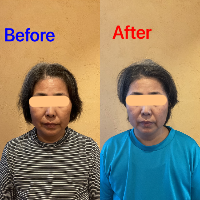 美容患者3