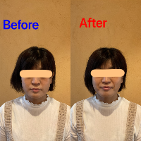 美容患者6