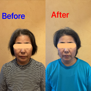 美容患者4