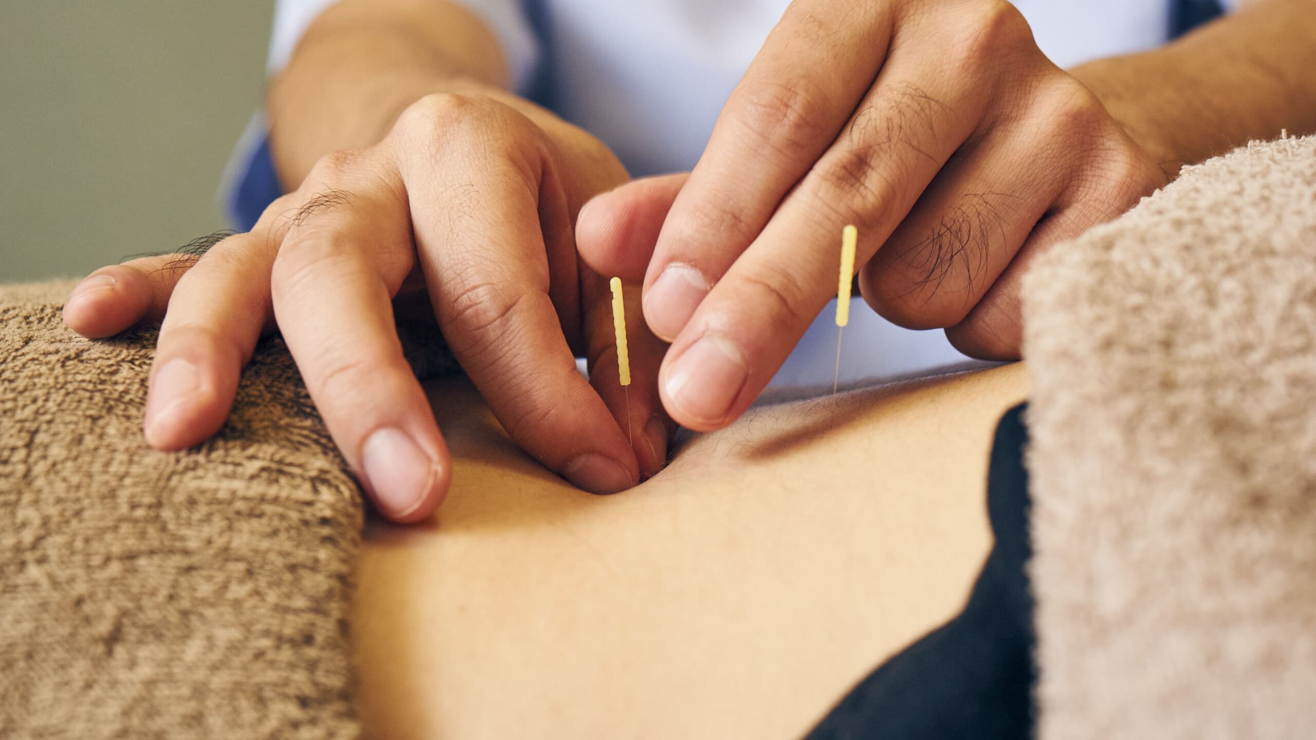 鶴崎鍼灸院　腰の鍼施術